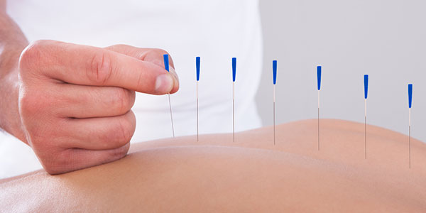 acupuntura para artrose